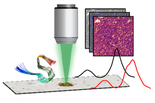 Chemical Imaging with spatially resolved Infrared spectroscopy